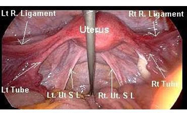 Laparoscopy surgeon in Ahmedabad