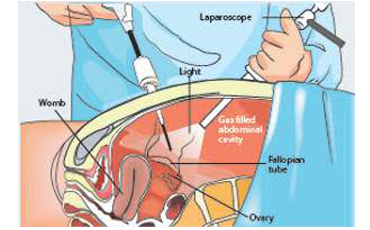 Laparoscopic surgeon in vijay cross road